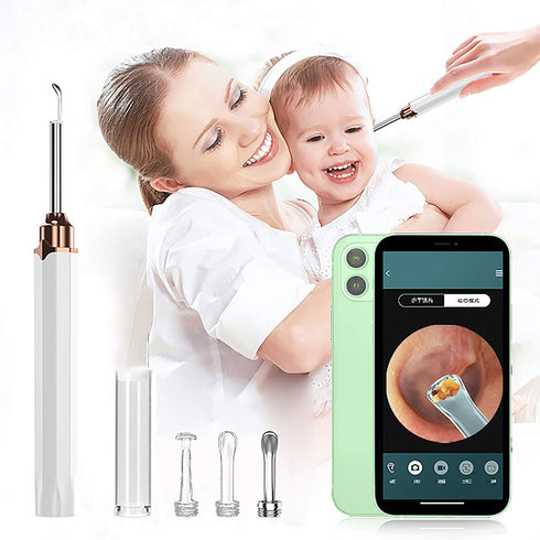 Smart WIFI Visual Ear Cleaner and Ear Wax Removal with HD Camera